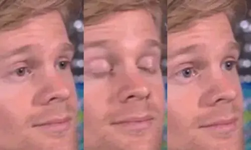 Ảnh Blinking Guy meme chớp mắt hoang mang dành cho dân mạng thích cà khịa