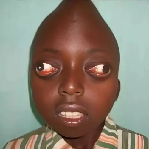 204 203