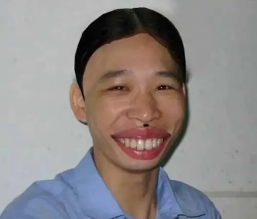 81 80