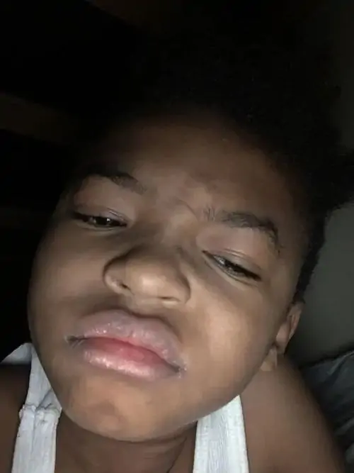 156 155